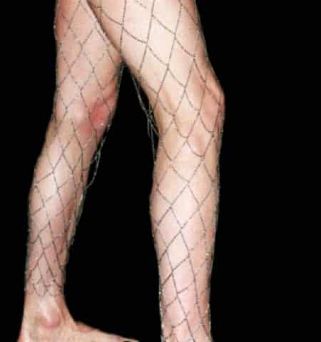 A girl is dressed in black and white Fishnet Stockings Sparkle.