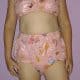 Adults love Elastic Printed Diapers. In the photo, he is wearing a Pink Elastic Printed Adult Diaper.